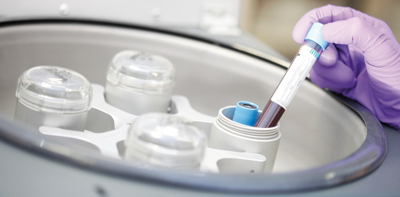 Medicina regenerativa en la odontología
